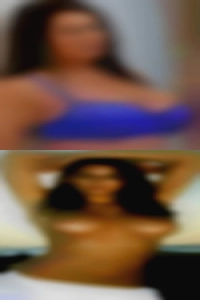 dioneRash, , 
